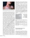 Pellagroid Dermatitis During a Ketogenic Diet and Anti-Epileptic Therapy