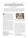 Hair Transplanting: An Important but Often Forgotten Treatment for Female Pattern Hair Loss