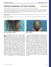 Salt-Losing Tubulopathy and Chronic Dermatitis