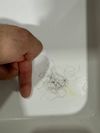 Is Hair Loss Every 3-4 Days Normal After Resuming Minoxidil?