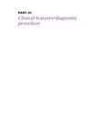Plaque Psoriasis: Clinical Characteristics, Diagnostic Methods, and Differential Diagnoses
