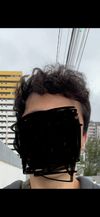 25M: Hair Thinning Despite 2 Years of Oral Minoxidil &amp; DHT Blocker Use