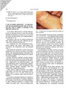 A Case of Systemic Mastocytosis: An Ultrastructural and Immunohistochemical Study of Dermal Mast Cells in Relation to Activation of the Epidermal Melanin Unit