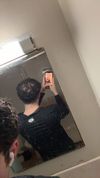 25M on Finasteride &amp; Oral Minoxidil for 8-10 Months: Seeking Advice on Crown Regrowth