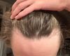 17M noticing hair shedding; using hair products, seeking advice