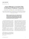 Anagen Effluvium in Association With Extracorporeal Membrane Oxygenation