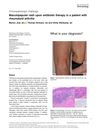 Maculopapular Rash Upon Antibiotic Therapy in a Patient with Rheumatoid Arthritis