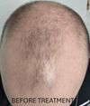 2 years progress pics - need advice