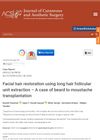 Facial Hair Restoration Using Long Hair Follicular Unit Extraction: A Case of Beard to Moustache Transplantation