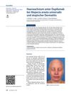 Hair Growth Under Dupilumab in Alopecia Areata Universalis and Atopic Dermatitis