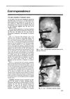 CO2 Laser Treatment of Traumatic Tattoos