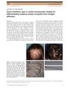 Color-Transition Sign: A Useful Trichoscopic Finding for Differentiating Alopecia Areata Incognita from Telogen Effluvium