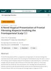 A Novel Atypical Presentation of Frontal Fibrosing Alopecia Involving the Frontoparietal Scalp