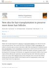 New Idea for Hair Transplantation to Preserve More Donor Hair Follicles