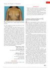 An Effective and Novel Technique for Hair Control in Craniofacial Surgery