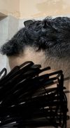 29/7. Taking pictures today for journal. First 3 pictures from today and last 2 from 6 months old. Any comments anyone? I feel like my hairline is slowly receding even being on medication. I just don’t know what to do to stop it