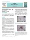 Unexpected Diagnosis of Basal Cell Carcinoma
