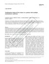 Azathioprine-Induced Liver Injury in a Patient with Multiple Autoimmune Syndrome