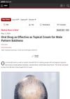 Oral Drug As Effective As Topical Cream For Male Pattern Baldness