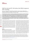 Fgf9 From Dermal γδ T Cells Induces Hair Follicle Neogenesis After Wounding