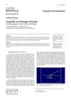 Ultrasonography in Hair Follicle Pathology