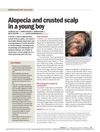 Alopecia and Crusted Scalp in a Young Boy