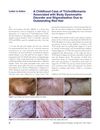 A Childhood Case of Trichotillomania Associated with Body Dysmorphic Disorder and Stigmatization Due to Outstanding Red Hair