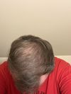 2 month check in