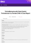 Trichotillomania with Giant Gastric Trichobezoar in a Female Child: A Case Report
