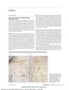 Dirty Dots as a Normal Trichoscopic Finding in the Elderly Scalp