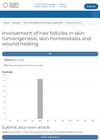 Involvement of Hair Follicles in Skin Tumorigenesis, Skin Homeostasis, and Wound Healing