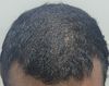 Comparing Hair Growth After 2 Weeks Post-Buzz Cut: Regrowth or Just Longer Hair?