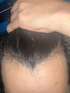 26M is this progress or loss