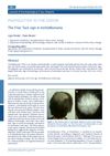 The Friar Tuck Sign in Trichotillomania