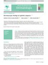 Dermatoscopic Findings of Syphilitic Alopecia