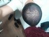 Considering a #1 Buzz Cut for Crown Thinning; Currently on Dutasteride + Minoxidil