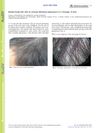 Banded Scalp Hair with an Unusual Glistening Appearance in a Teenager: A Quiz