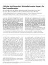 Follicular Unit Extraction: A Minimally Invasive Hair Transplantation Method