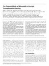 The Potential Role of Minoxidil in the Hair Transplantation Setting