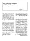 Topical Minoxidil Used Before and After Hair Transplantation