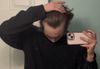 18m what norwood is this and what can i do please help