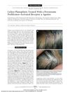 Lichen Planopilaris Treated With a Peroxisome Proliferator-Activated Receptor Gamma Agonist