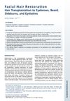 Facial Hair Restoration Techniques and Outcomes