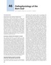 Pathophysiology of the Burn Scar