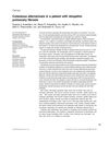 Cutaneous Alternariosis in a Patient with Idiopathic Pulmonary Fibrosis