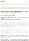 Chronic Urticaria Versus Dermatomyositis in a Case of T-Cell Large Granular Lymphocytic Leukemia
