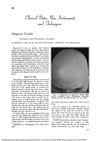 Alopecia Totalis: Significant Hair Regrowth with Fluocinolone Acetonide Cream
