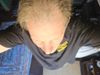 68m Hair loss remedies - been using minoxidol but hair loss now seems to be increasing. Is there another treatment that may work better? Or is my age taking over?