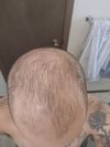 Topical Fin/Min Progress