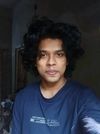 Documenting Recovery from Minoxidil-Induced Hair Loss Over 6 Months